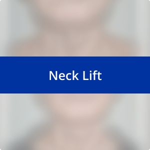 Image for /media/2m0dthya/neck-lift.png