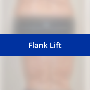 Image for /media/lvdjmkur/flank-lift.png