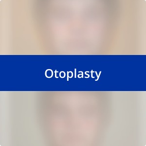 Image for /media/zviodjse/otoplasty.png